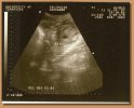 Roxanne's exterior ultrasound November 19th, 2007.